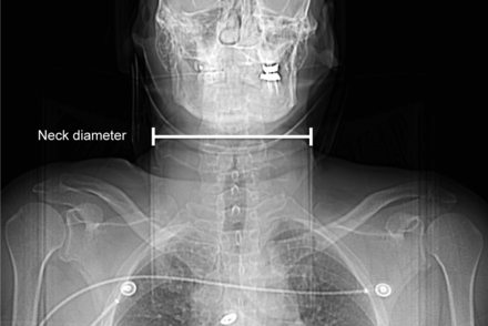 Fig 5.