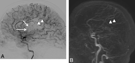 Fig 3.