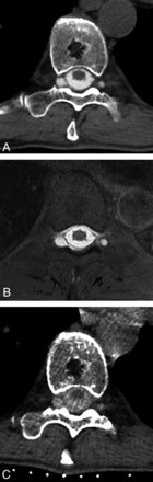 Fig 3.