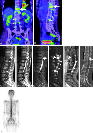 Fig 2.