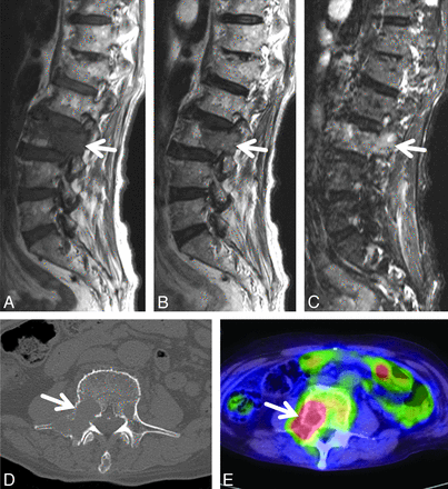 Fig 3.