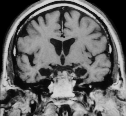 Fig 5.