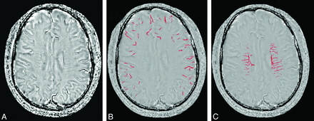 Fig 1.