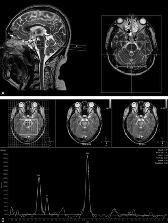 Fig 1.
