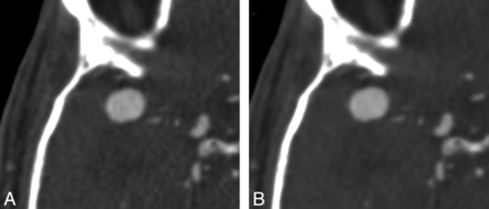 Fig 4.