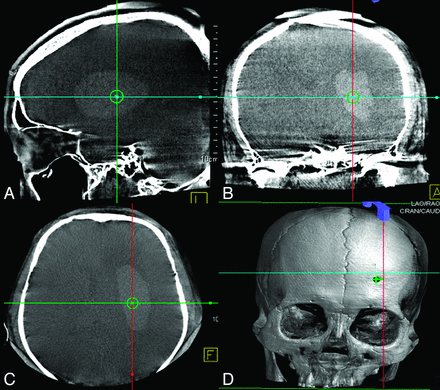 Fig 2.