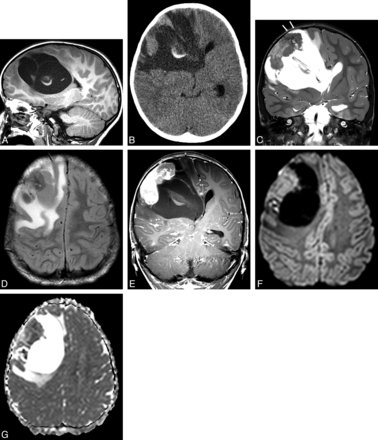 Fig 1.