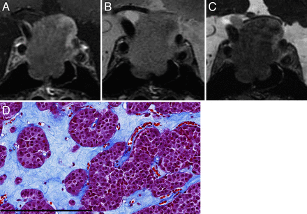 Fig 2.