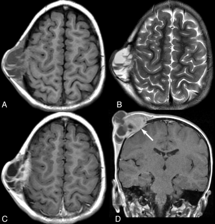 Fig 1.