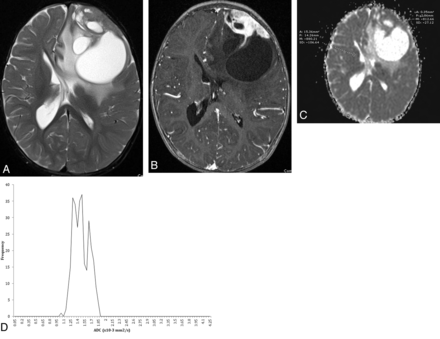 Fig 3.