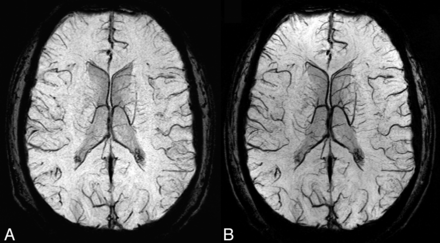 Fig 3.