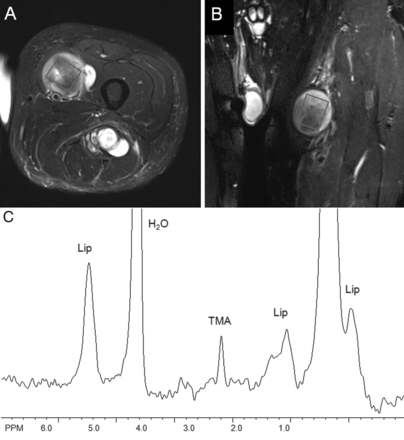 Fig 1.