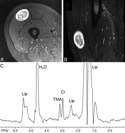 Fig 2.