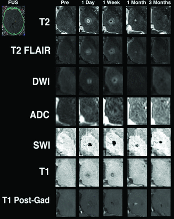 Fig 3.