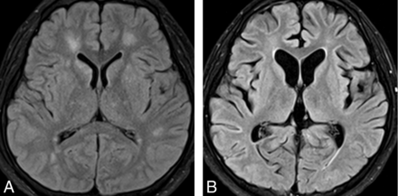 Fig 6.