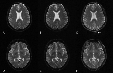Fig 1.