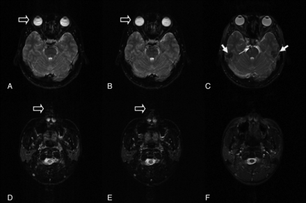 Fig 2.
