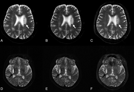 Fig 3.