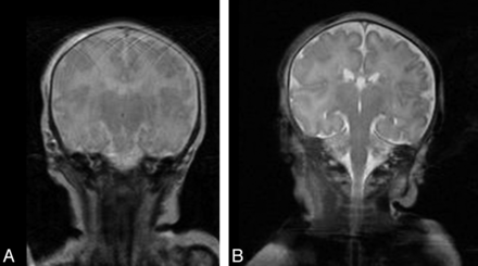 Fig 4.
