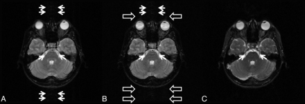 Fig 5.