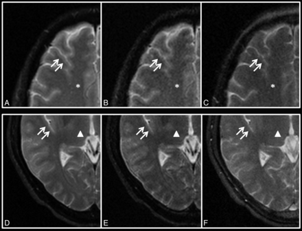 Fig 6.