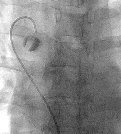 Fig 5.