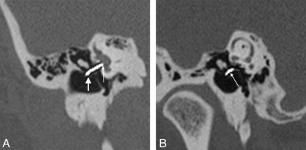 Fig 5.