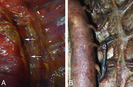 Fig 3.