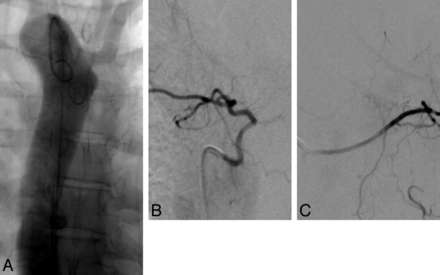 Fig 4.
