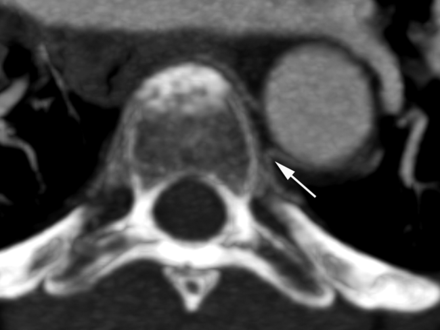 Fig 5.