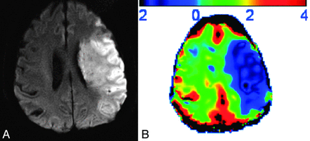 Fig 3.