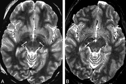 Fig 3.