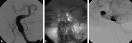 Fig 1.