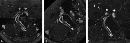 Fig 2.