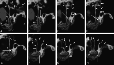 Fig 5.