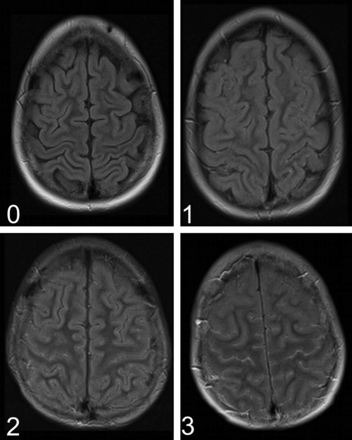 Fig 1.