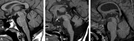 Fig 1.