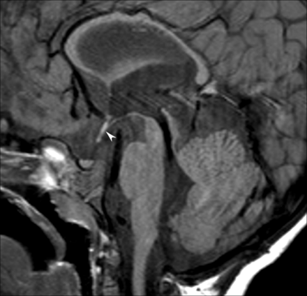 Fig 5.