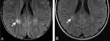 Fig 6.