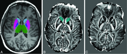 Fig 1.