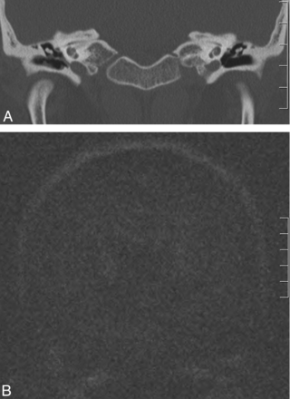 Fig 1.