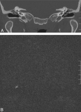 Fig 2.