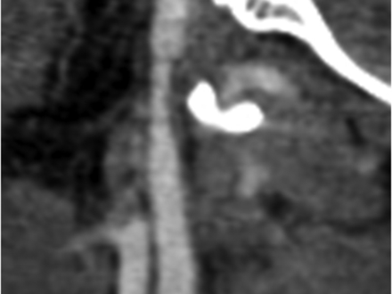 Fig 3.