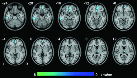 Fig 1.