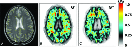 Fig 3.