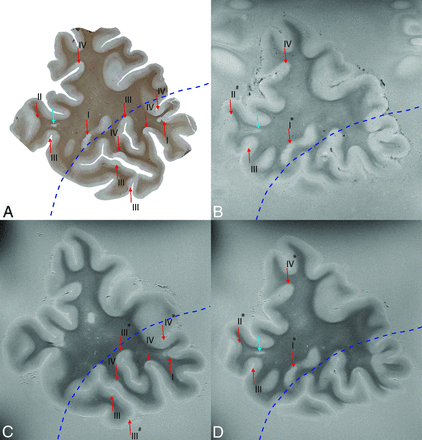 Fig 1.