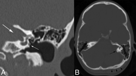 Fig 1.