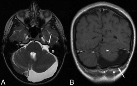 Fig 2.
