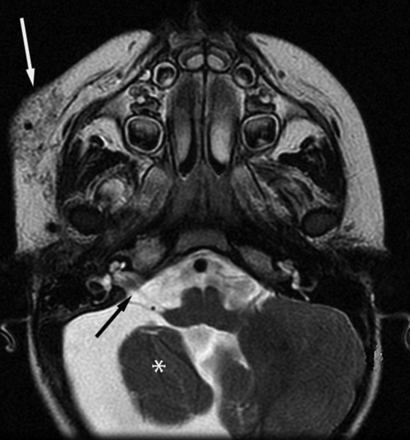 Fig 4.
