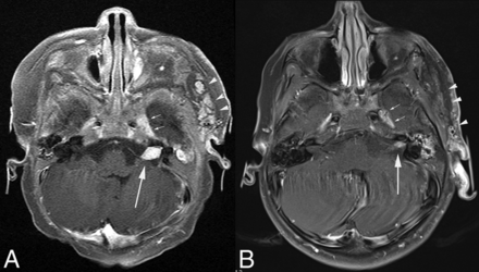 Fig 5.